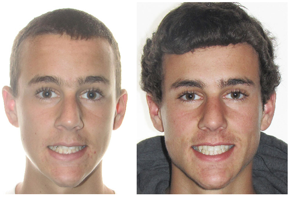 Holley Dental Care