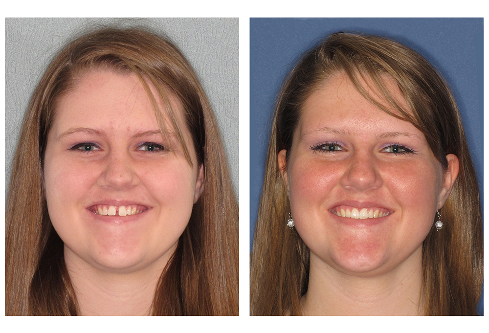 Holley Dental Care