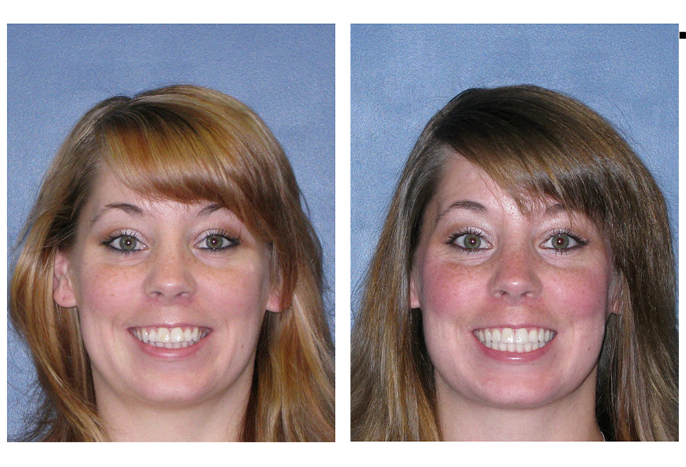 Holley Dental Care