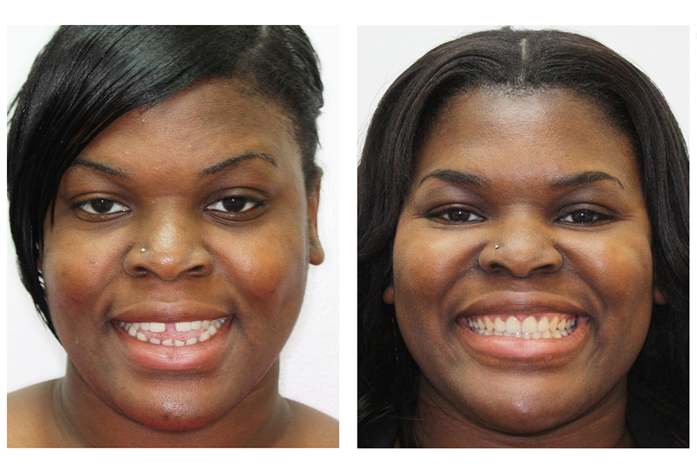 Holley Dental Care