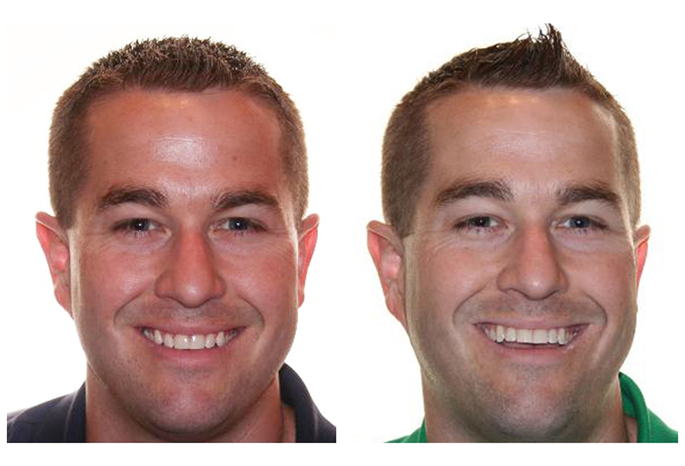 Holley Dental Care