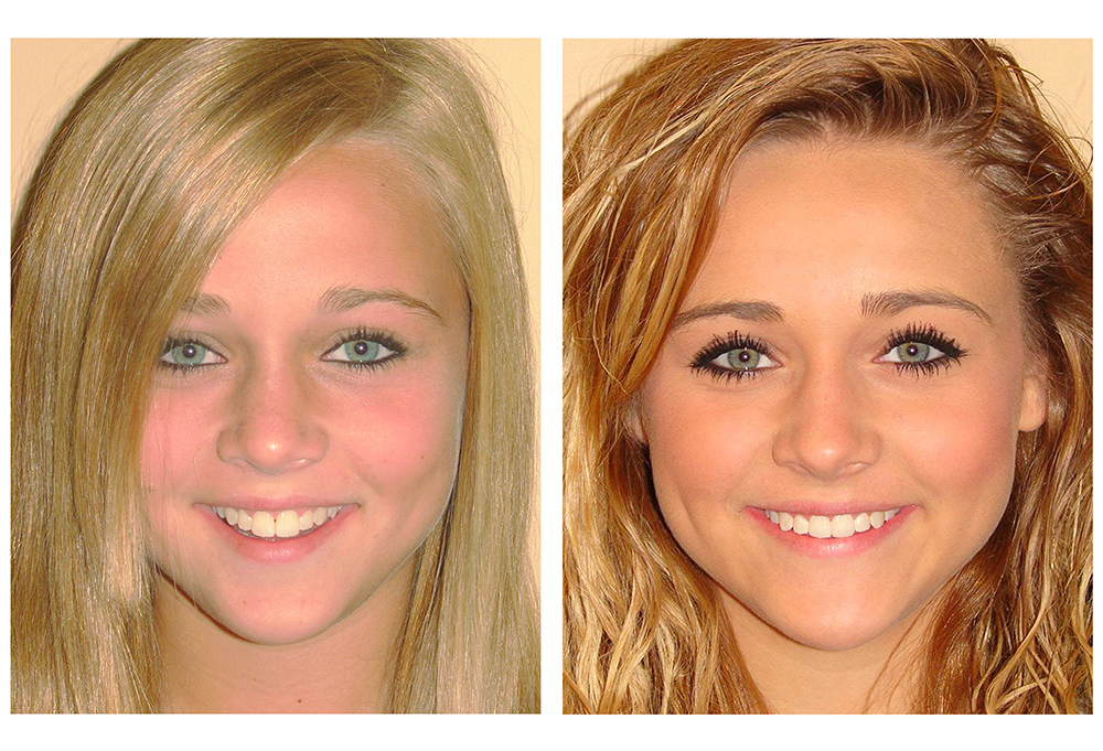 Holley Dental Care
