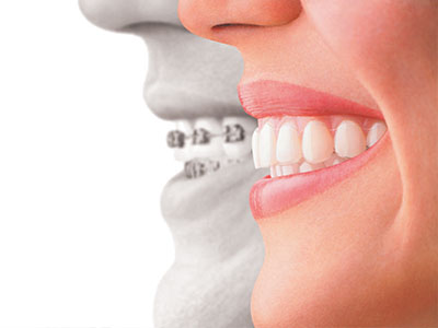 Holley Dental Care | Dental Fillings, Teeth Whitening and Sports Mouthguards