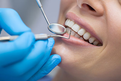 Holley Dental Care | Dental Cleanings, TMJ Disorders and Teeth Whitening
