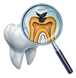 Holley Dental Care | Sedation Dentistry, Invisalign reg  and Implant Dentistry