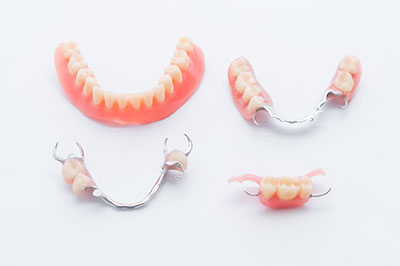 Holley Dental Care | Dental Bridges, Veneers and Periodontal Treatment