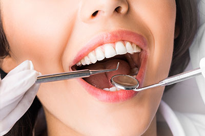 Holley Dental Care | Teeth Whitening, Digital Radiography and Dentures