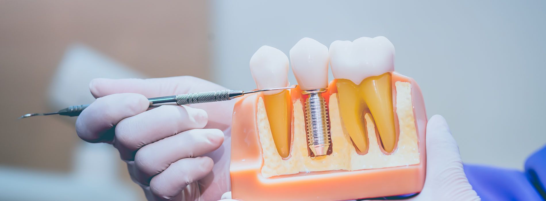 Holley Dental Care | Veneers, Extractions and Dental Cleanings