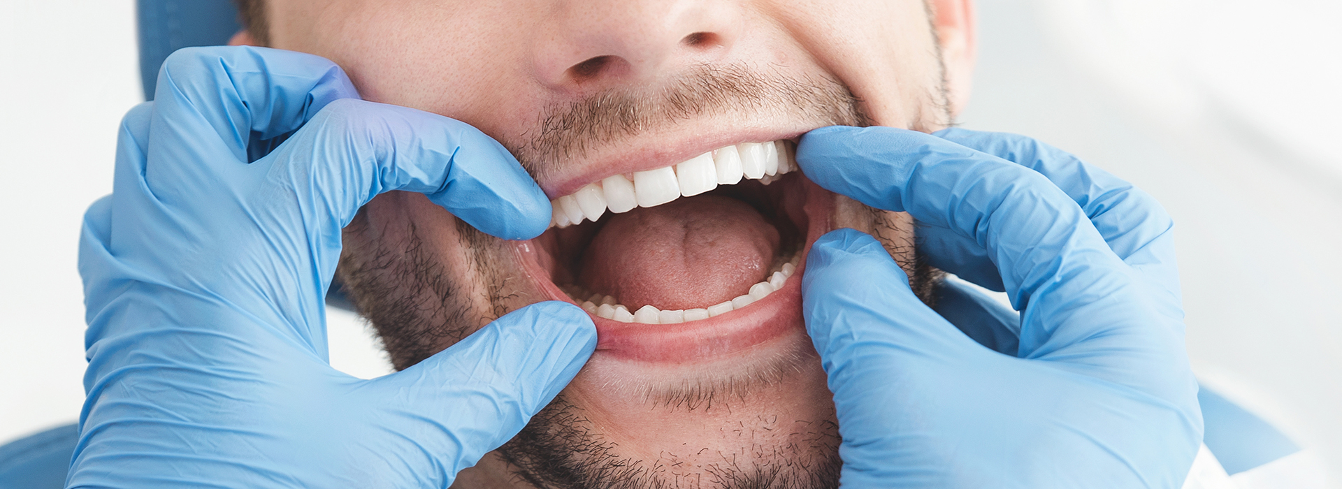 Holley Dental Care | Veneers, Sedation Dentistry and Crowns  amp  Caps