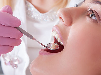 Holley Dental Care | Root Canals, Oral Exams and Oral Cancer Screening