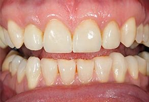 Holley Dental Care | VELscope reg  Cancer Screening, Sedation Dentistry and Oral Exams