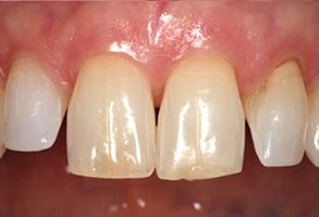 Holley Dental Care | Teeth Whitening, Dental Fillings and Extractions