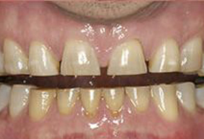 Holley Dental Care | Sedation Dentistry, Implant Restorations and Extractions